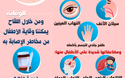 مرض الحصبة التعريف والأعراض والمضاعفات والوقاية