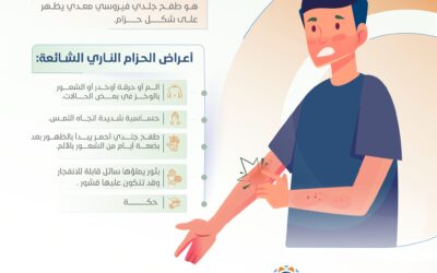 الحزام الناري.. تعريفه وأعراضه وطرق الوقاية