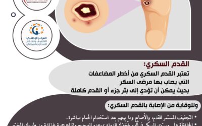 الوقاية من الإصابة بالقدم السكري
