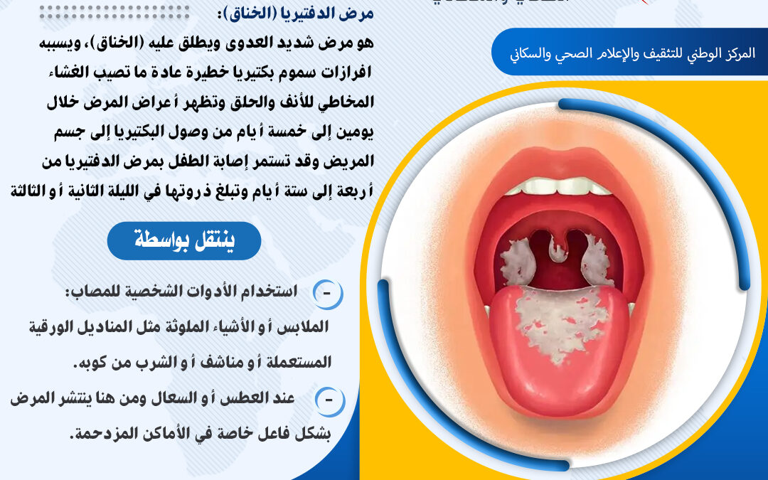 مرض الدفتيريا (الخناق)